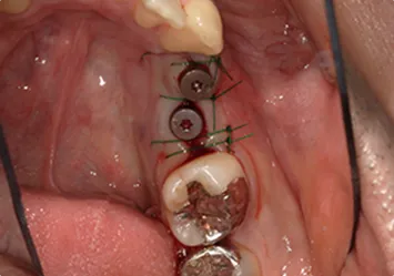 治療後写真 恵比寿南DENTAL