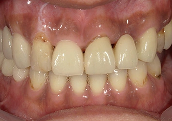 治療後写真 恵比寿南DENTAL