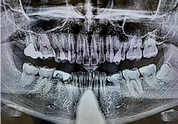 治療前写真 恵比寿南DENTAL