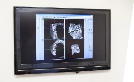 シミュレーション機器 恵比寿南DENTAL