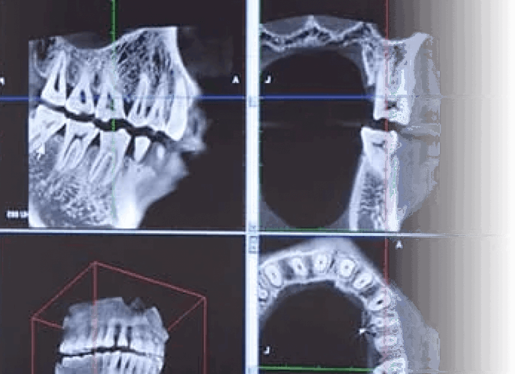 CTによる正確な診査診断