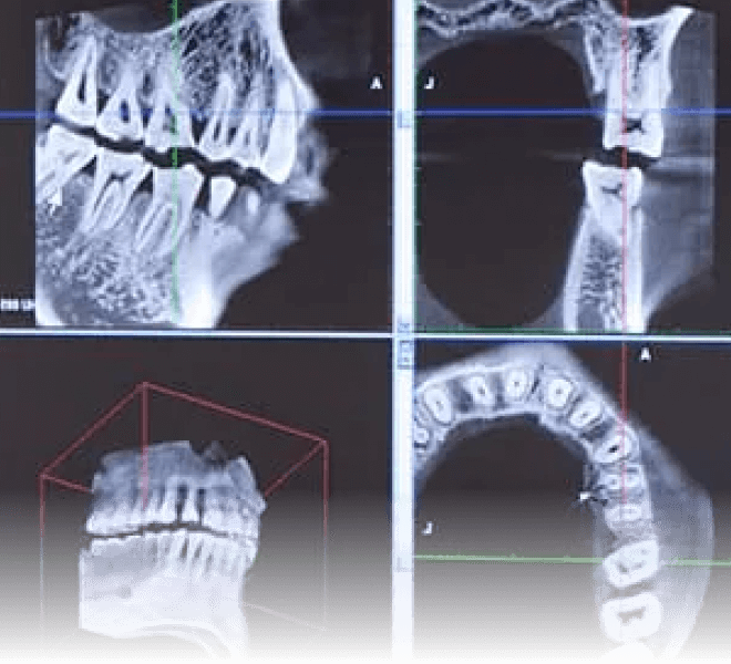CTによる正確な診査診断