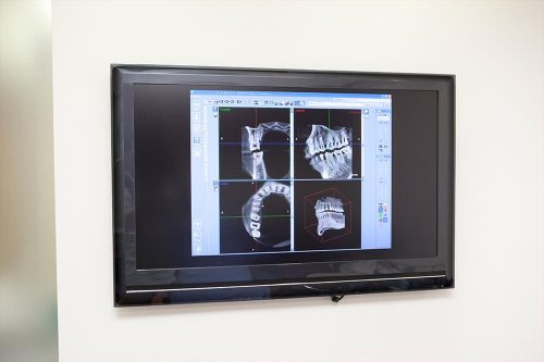 歯科用CTによる正確な診査診断